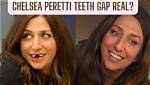 Unveiling the Truth: Does Chelsea Peretti Have Fake Teeth?