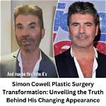 Unveiling the Truth: Does Simon Cowell's Son Have Down Syndrome?
