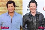 Wayne Newton's Plastic Surgery Journey