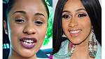 Where Did Cardi B Get Her Teeth Done at? Celebrity. Fm #1 Official Stars, Business & People N